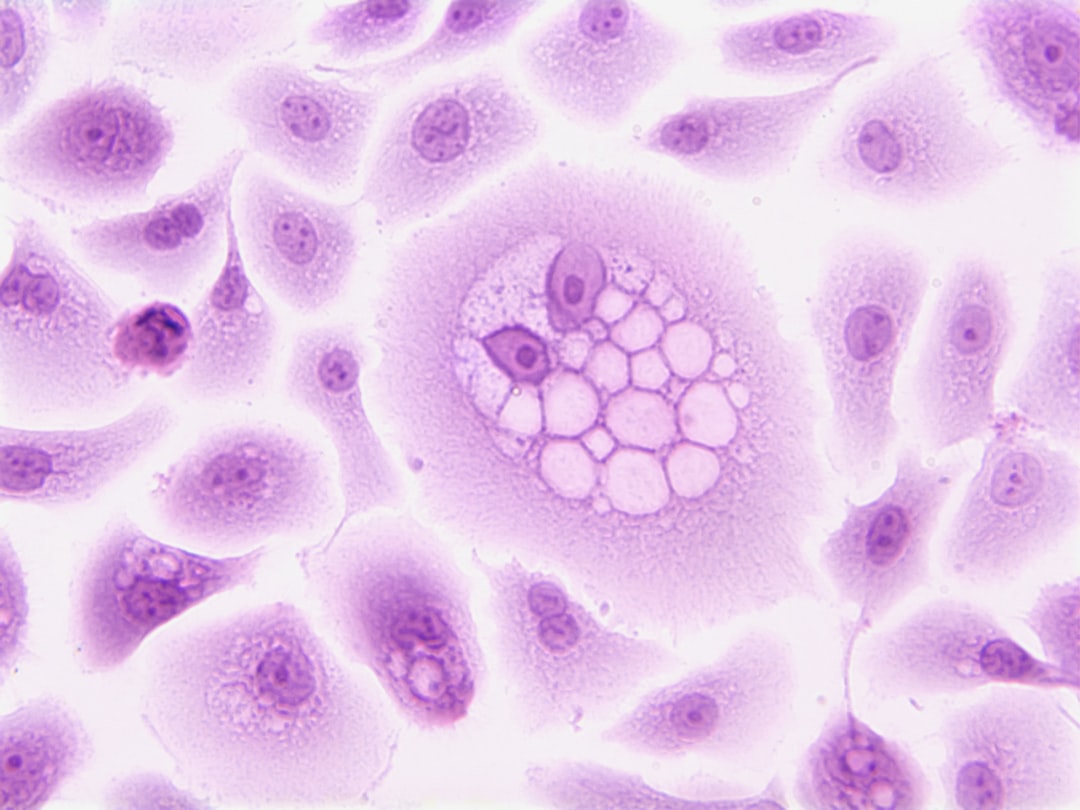 Topic 8: Living Better with Diabetes: Anita’s Stem Cell Therapy Experience in India